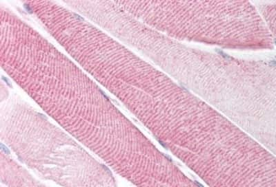 Immunohistochemistry-Paraffin: NK2R Antibody [NBP3-14420]